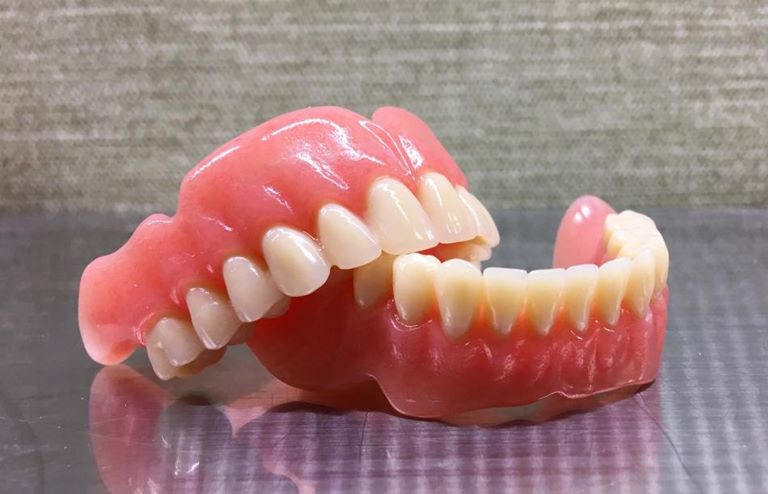 Общие показания к протезированию зубов