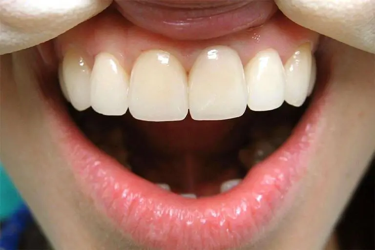Ошибки стоматологического лечения