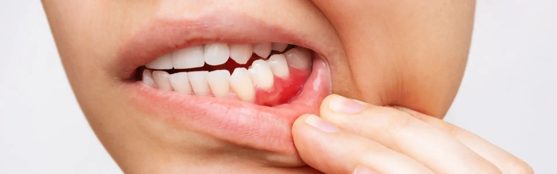 Народные средства для ухода за зубами и полостью рта - МастерДент