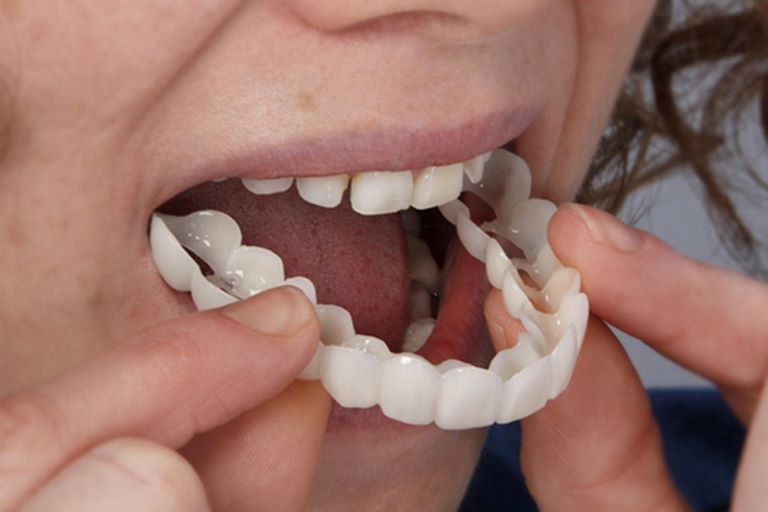 Причины выпадения зубов