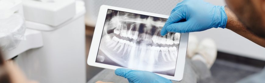 Клиновидный дефект зубов: механизм появления, способы лечения