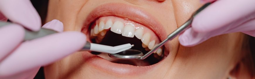 Дистопированный зуб: симптомы, диагностика и удаление