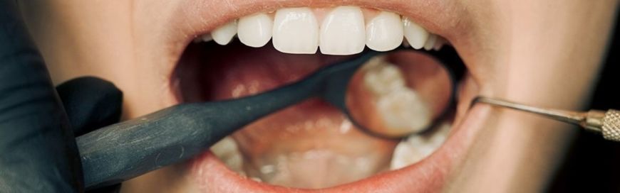 Мертвый зуб: симптомы, лечение, профилактика