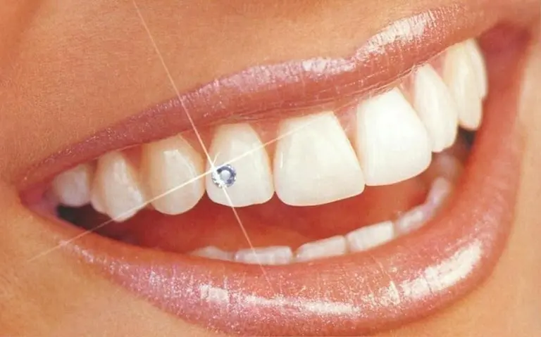 возможности эстетической стоматологии