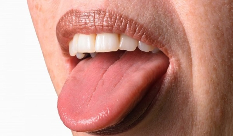 почему важно чистить язык