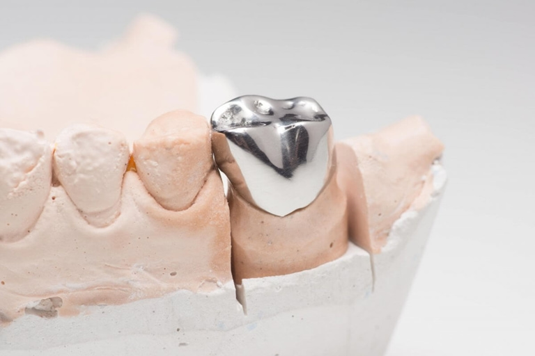 материалы для изготовления металлической коронки на зуб