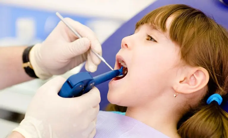 фторирование зубов у детей