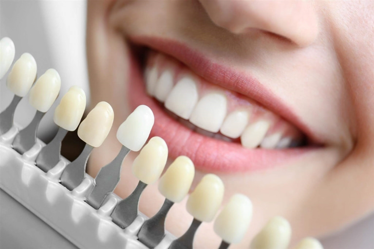 каким образом закрепляются временные зубные протезы