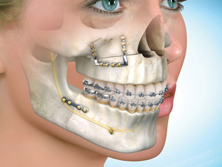 челюстно-лицевое направление хирургической стоматологии