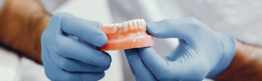 Что значит имплантация зубов «под ключ»