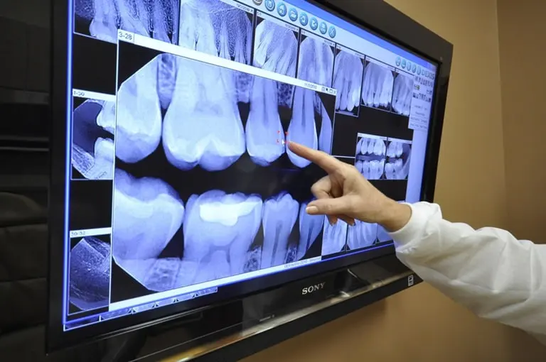 показания к рентгену в стоматологии