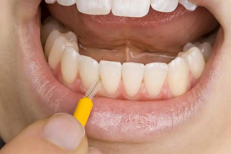 сколько длится адаптационный период после шинирования зубов нижней челюсти