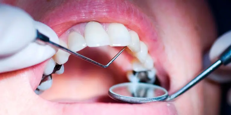 осложнения после удаления зуба-шестерки