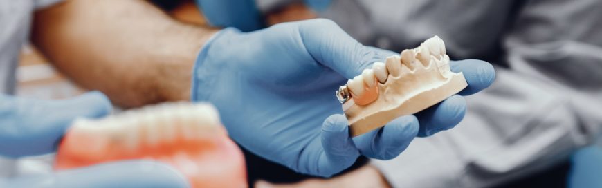 Временный имплант: новый подход к замене потерянных зубов
