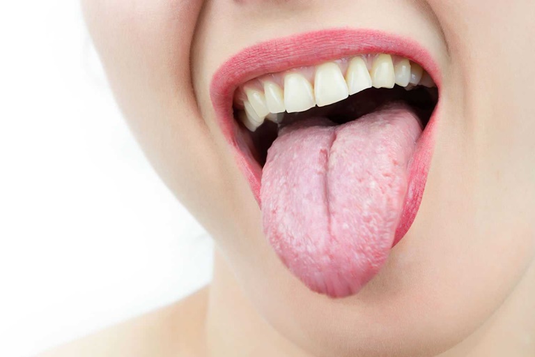 возможные осложнения травм языка