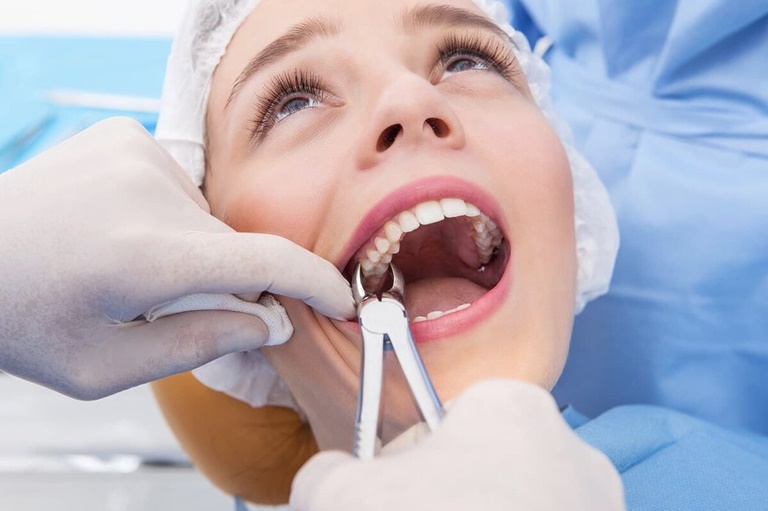 удаление корней зубов верхней и нижней челюсти