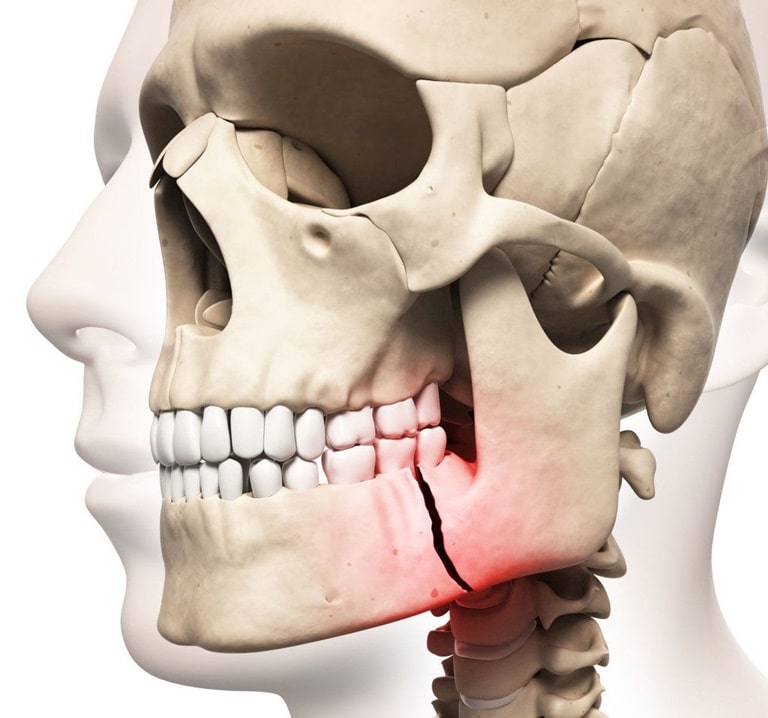 причины и симптомы кисты челюсти