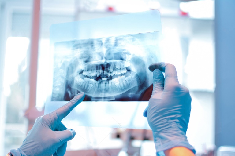 рентгенографическое обследование челюсти