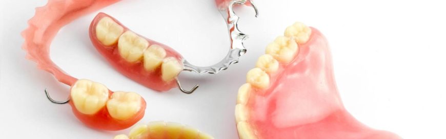Как привыкнуть к съемным зубным протезам и можно ли ускорить этот процесс