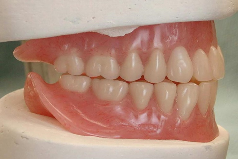 состояние зубных единиц