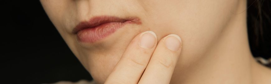 Заеды в уголках рта: причины и способы лечения