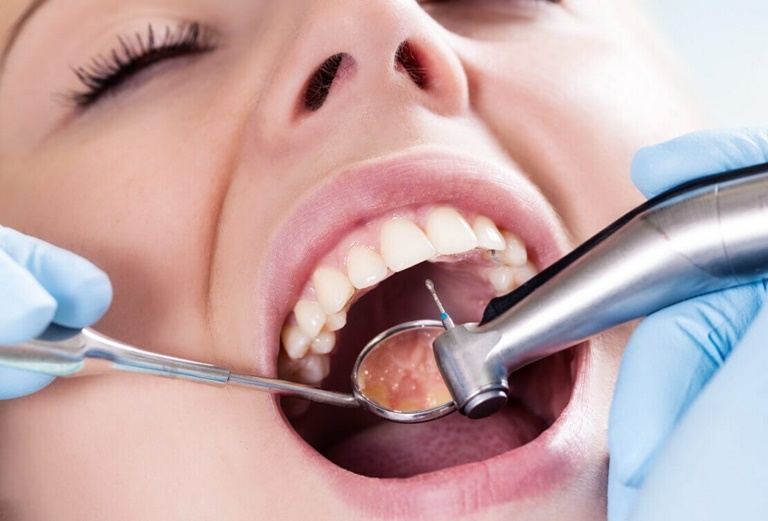 стоматологические методы диагностики кариеса между зубами