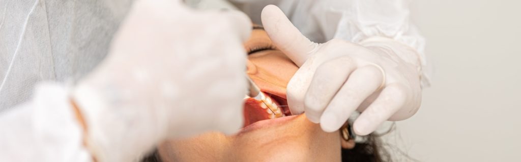 После удаления зуба болят соседние зубы: причины и лечение